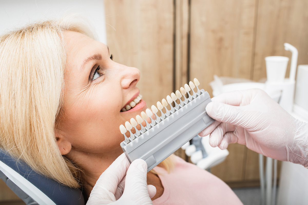 Will Dental Veneers Be Covered by Insurance? | Oak Road Dentistry